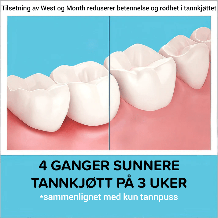 Tenner Totalpleie Munnskyllevæske