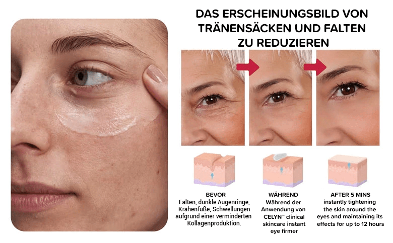 Clinical SkinCare Øyeblikkelig Oppstrammer for Øynene