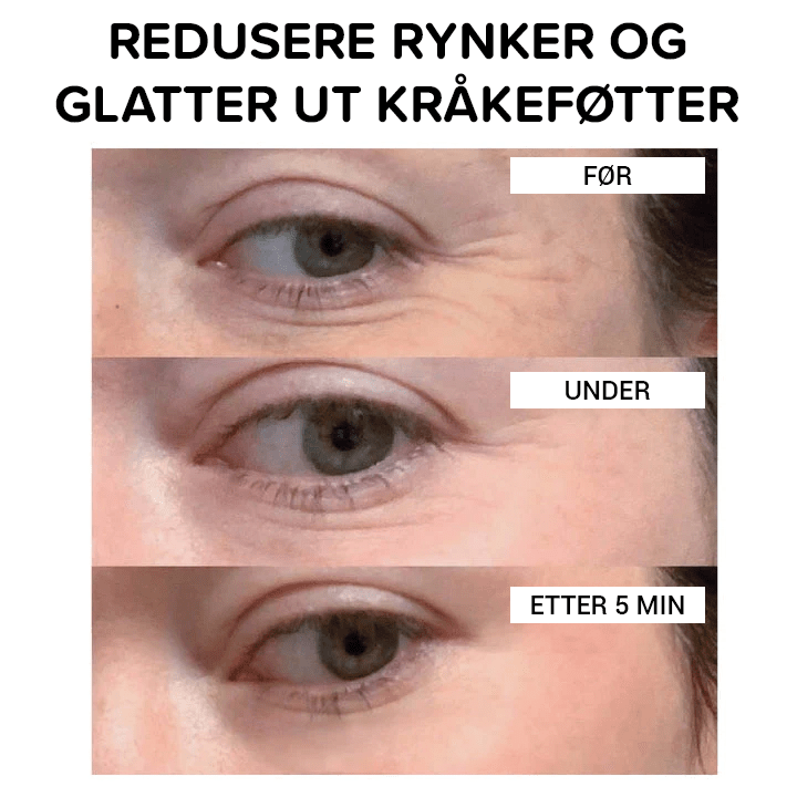 Clinical SkinCare Øyeblikkelig Oppstrammer for Øynene