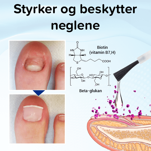 OnyxoGuard Serum for vekst og reparasjon av negler