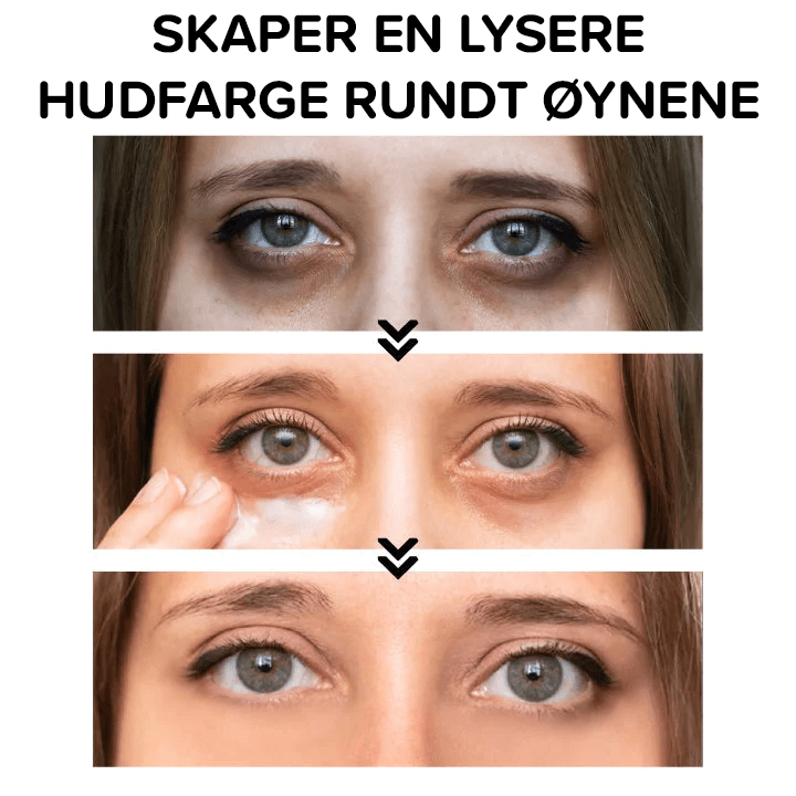 Clinical SkinCare Øyeblikkelig Oppstrammer for Øynene