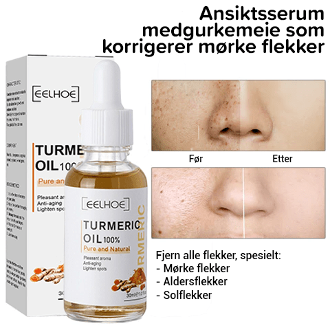 Kurkuma Mørk Flekk Korrektor Ansikt Serum